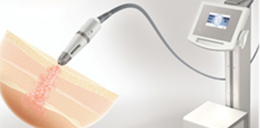 REGENERATIVE SKIN TREATMENT LAUNCHED